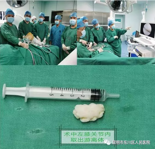 东川区人民医院成功开展首例关节镜手术